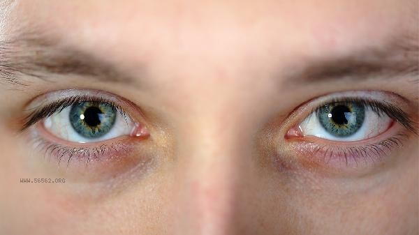 Can permanent double eyelids be made for every type of eye without surgery, thread embedding, or leaving no marks