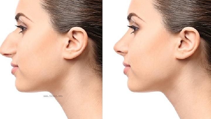 What to do if you have a chubby face? These methods are effective in slimming the face