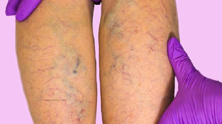 Why are thighs and buttocks fat