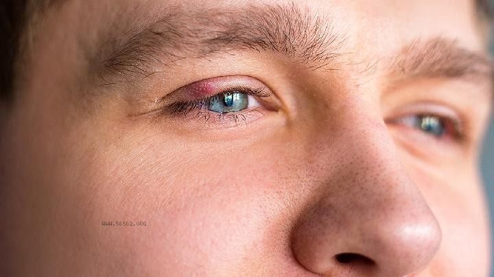 Tears shed or due to excessive obesity