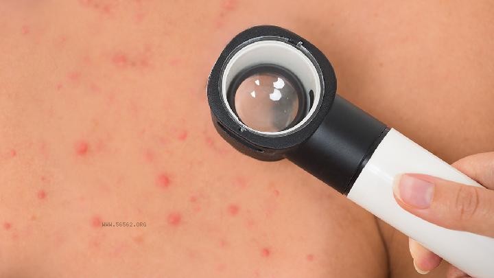 Will long-term use of pine pollen lead to weight gain