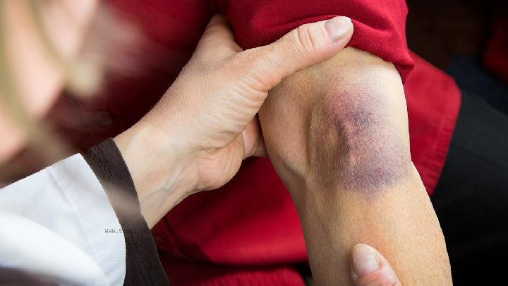 How to tighten the sagging skin after weight loss