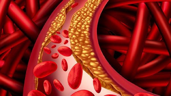 What is the reason for the high absolute value of monocytes