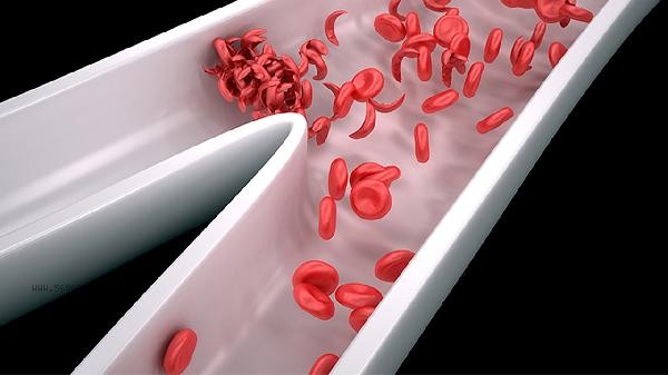 What does a high red blood cell count in urine sediment indicate