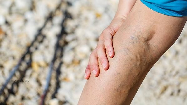 What is magnetic resonance angiography