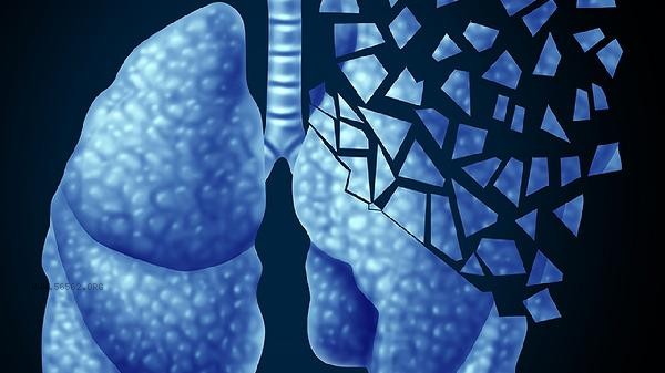 Should liver biopsy be performed for repeated high transaminase levels