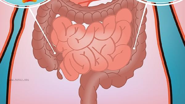 Is intestinal metaplasia important in gastroscopy pathology report