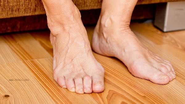 Can traditional Chinese medicine cure varicocele