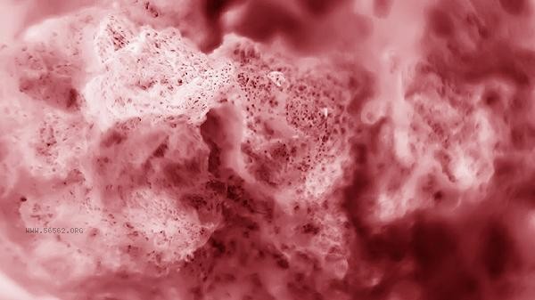 What should be done if there is a high level of epithelial cells in the urine routine examination