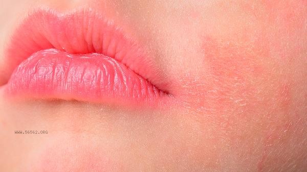 What are the tests for systemic lupus erythematosus