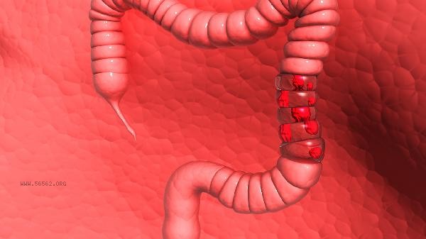 What are the examination ranges of electronic colonoscopy